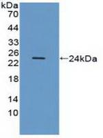 CD51 Antibody in Western Blot (WB)