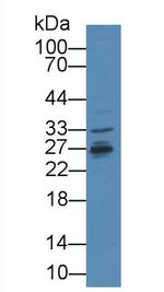 IFNAR2 Antibody in Western Blot (WB)