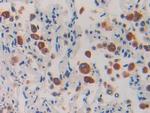 IL-1RAcP Antibody in Immunohistochemistry (Paraffin) (IHC (P))