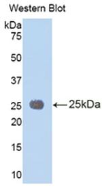 IL-1RAcP Antibody in Western Blot (WB)