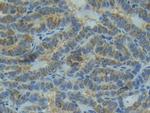 IL1R1 Antibody in Immunohistochemistry (Paraffin) (IHC (P))