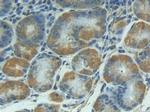 IL1R1 Antibody in Immunohistochemistry (Paraffin) (IHC (P))