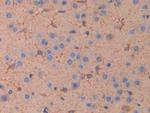 IL11RA Antibody in Immunohistochemistry (Paraffin) (IHC (P))