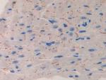 IL11RA Antibody in Immunohistochemistry (Paraffin) (IHC (P))