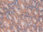 IL11RA Antibody in Immunohistochemistry (Paraffin) (IHC (P))