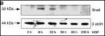 SNAIL Antibody in Western Blot (WB)