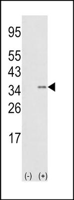 SNAIL Antibody in Western Blot (WB)