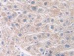 CD127 Antibody in Immunohistochemistry (Paraffin) (IHC (P))