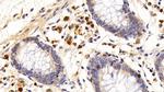 CD127 Antibody in Immunohistochemistry (Paraffin) (IHC (P))