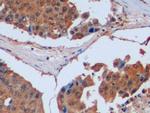 IDH1 Antibody in Immunohistochemistry (Paraffin) (IHC (P))