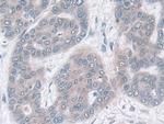 IDH2 Antibody in Immunohistochemistry (Paraffin) (IHC (P))