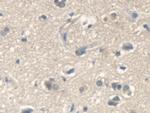 IARS Antibody in Immunohistochemistry (Paraffin) (IHC (P))