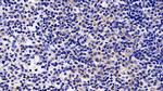 JAK2 Antibody in Immunohistochemistry (Paraffin) (IHC (P))