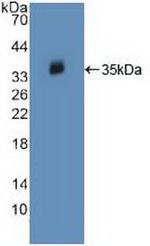 JAK2 Antibody in Western Blot (WB)