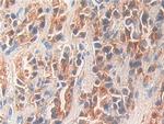 KLK11 Antibody in Immunohistochemistry (Paraffin) (IHC (P))