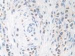 KLK11 Antibody in Immunohistochemistry (Paraffin) (IHC (P))