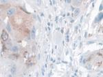 Kallikrein 14 Antibody in Immunohistochemistry (Paraffin) (IHC (P))