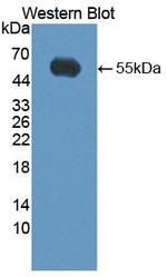 Kallikrein 14 Antibody in Western Blot (WB)