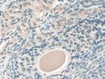 KATNA1 Antibody in Immunohistochemistry (Paraffin) (IHC (P))