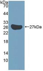 KATNA1 Antibody in Western Blot (WB)