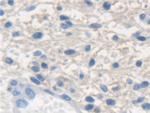 KRT33A Antibody in Immunohistochemistry (Paraffin) (IHC (P))