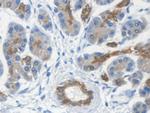 KRT33A Antibody in Immunohistochemistry (Paraffin) (IHC (P))