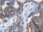 KRT33A Antibody in Immunohistochemistry (Paraffin) (IHC (P))