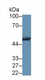 KRT33A Antibody in Western Blot (WB)