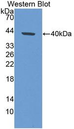 KRT33A Antibody in Western Blot (WB)