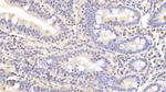 LDHB Antibody in Immunohistochemistry (Paraffin) (IHC (P))