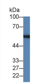 LMAN1 Antibody in Western Blot (WB)