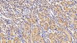 LEPR Antibody in Immunohistochemistry (Paraffin) (IHC (P))