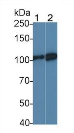 LEPR Antibody in Western Blot (WB)