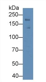 LEPR Antibody in Western Blot (WB)