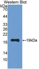 LEPR Antibody in Western Blot (WB)