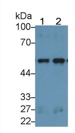 LSR Antibody in Western Blot (WB)