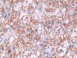 TDH Antibody in Immunohistochemistry (Paraffin) (IHC (P))