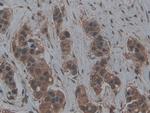 LTBR Antibody in Immunohistochemistry (Paraffin) (IHC (P))