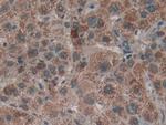 LTBR Antibody in Immunohistochemistry (Paraffin) (IHC (P))