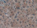 LTBR Antibody in Immunohistochemistry (Paraffin) (IHC (P))