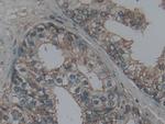 LTBR Antibody in Immunohistochemistry (Paraffin) (IHC (P))