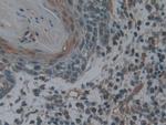 LTBR Antibody in Immunohistochemistry (Paraffin) (IHC (P))