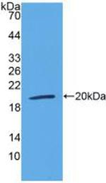 LTBR Antibody in Western Blot (WB)