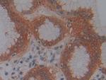 JMJD2A Antibody in Immunohistochemistry (Paraffin) (IHC (P))