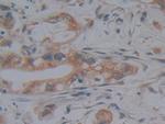 JMJD2A Antibody in Immunohistochemistry (Paraffin) (IHC (P))