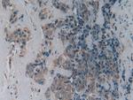 LPCAT3 Antibody in Immunohistochemistry (Paraffin) (IHC (P))