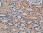 LPCAT3 Antibody in Immunohistochemistry (Paraffin) (IHC (P))