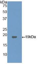 LPCAT3 Antibody in Western Blot (WB)