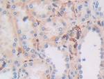 HLA-C Antibody in Immunohistochemistry (Paraffin) (IHC (P))