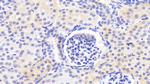 MPI Antibody in Immunohistochemistry (Paraffin) (IHC (P))